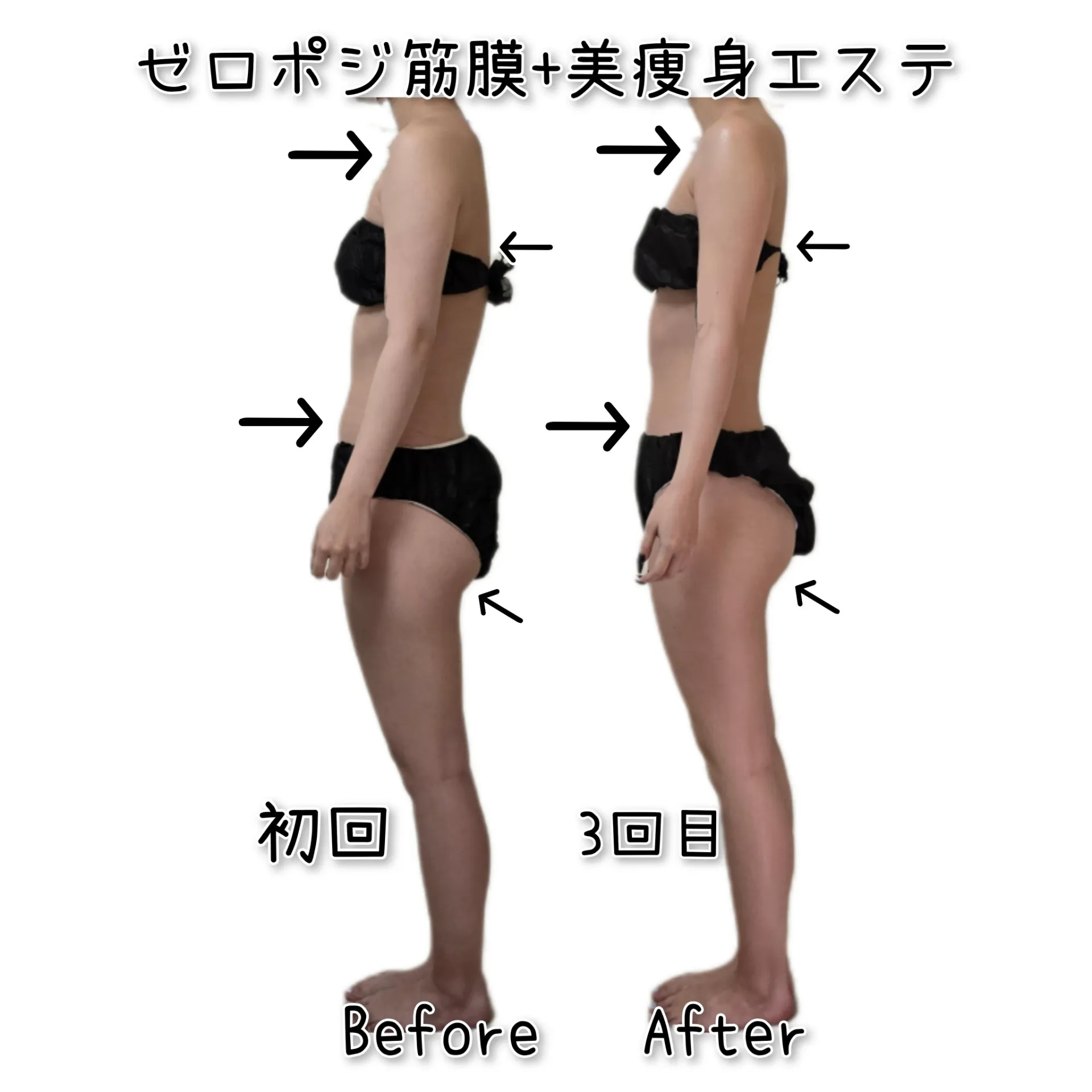 大人気✨ゼロポジ+美痩身エステ　【茨城県古河市エステサロン】