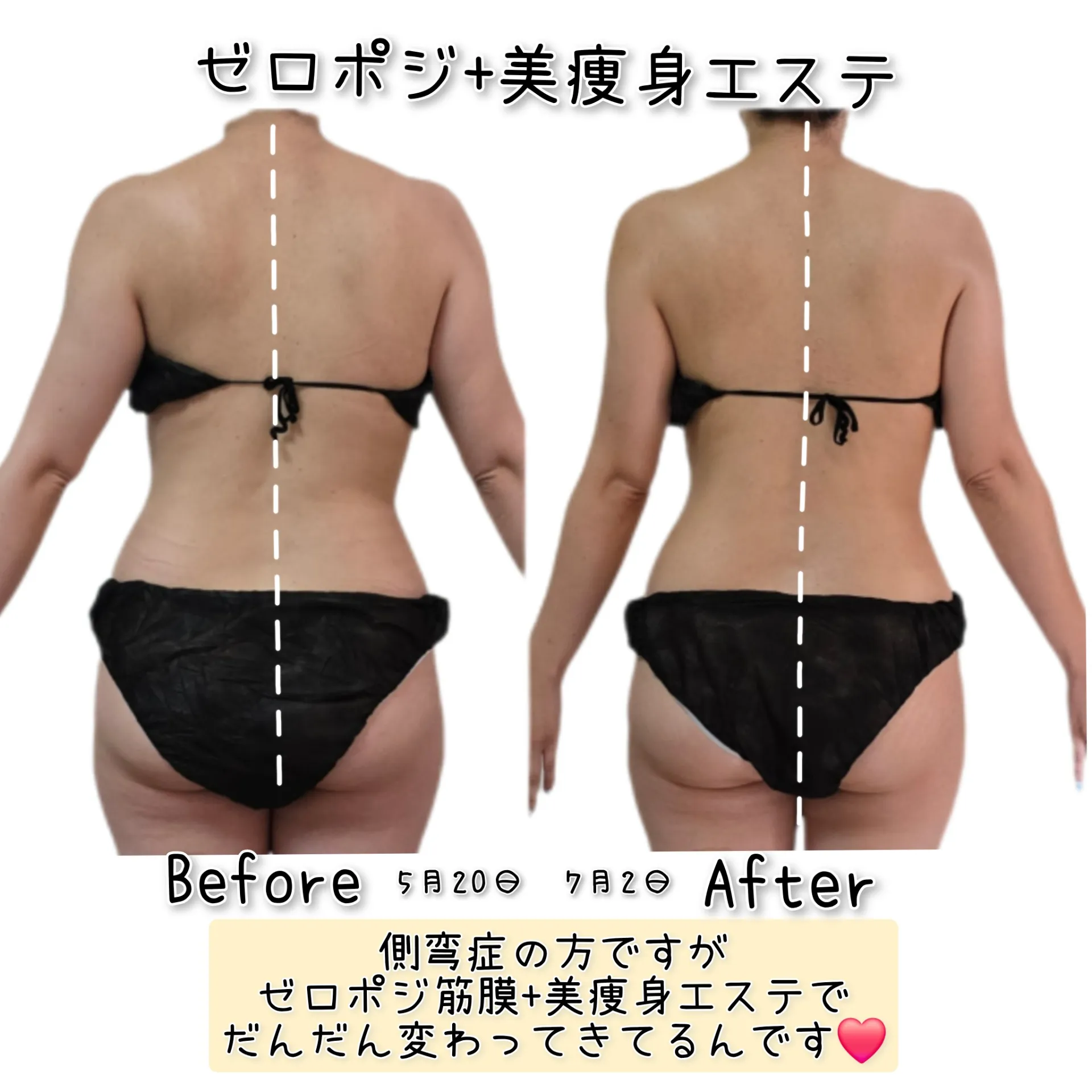 骨格矯正だけでは美しいボディーは作れない【茨城県古河市エステサロン】