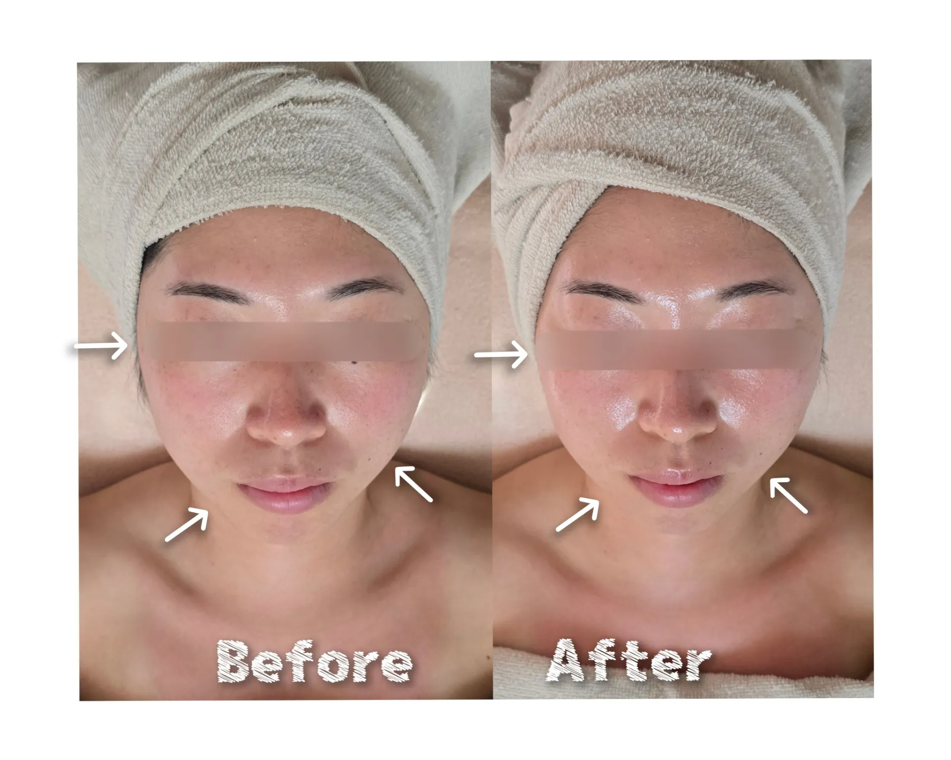 最近老けたなぁって思ったら。。。【茨城県古河市エステサロンへ】