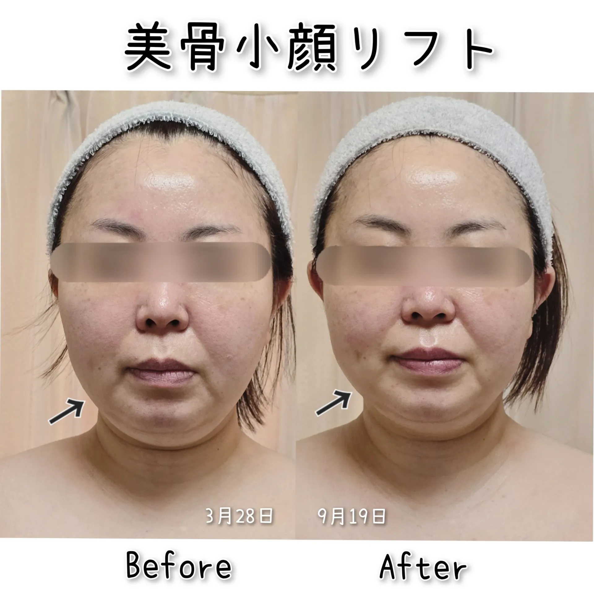 痩せた？って言われたい　【茨城県古河市エステサロン】