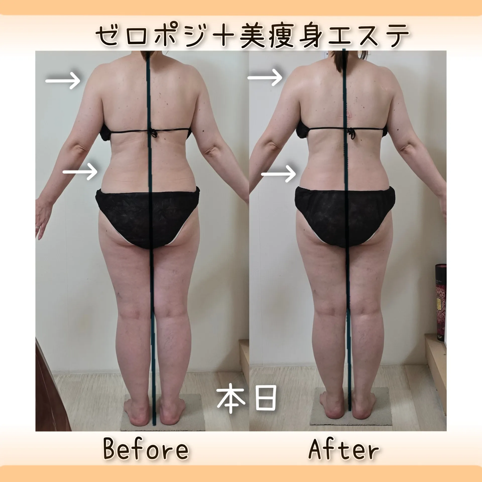 痩せたい【茨城県古河市エステサロン】