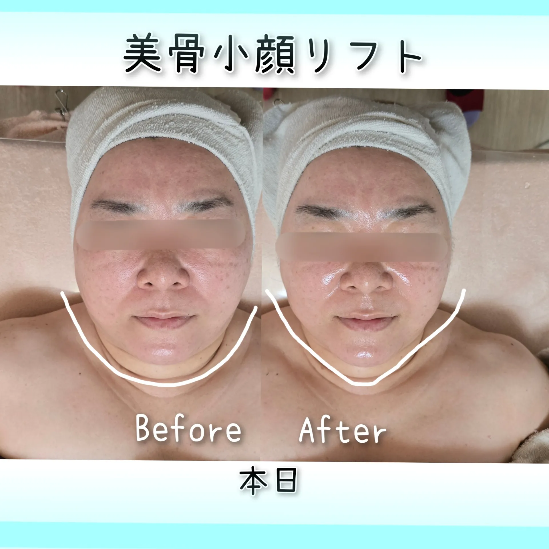 小顔になりたい【茨城県古河市エステサロン】