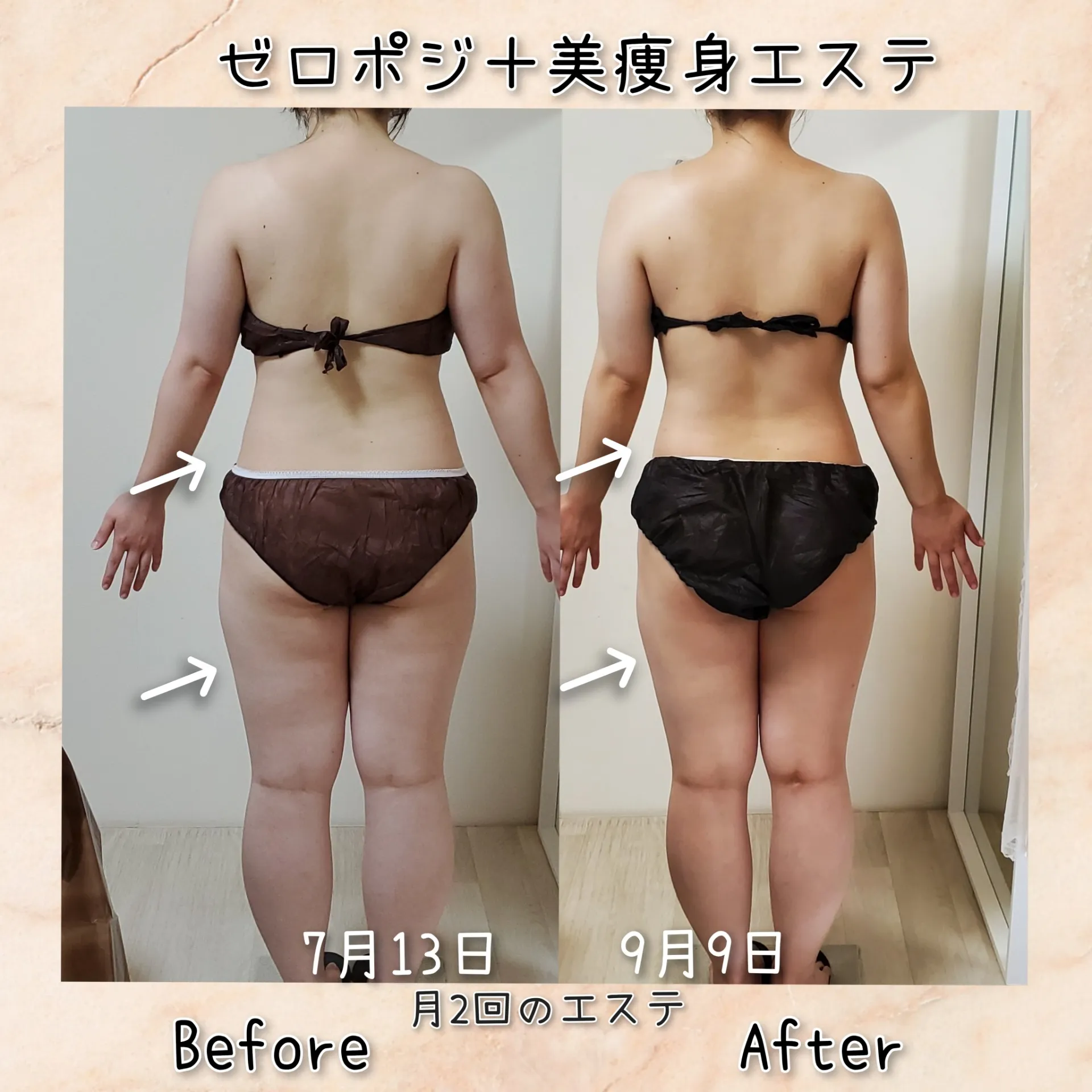 2ヶ月で別人化！！！【茨城県古河市エステサロン】